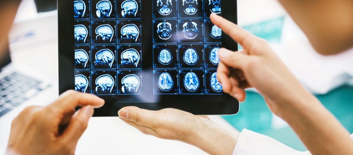 Qu'est-ce qu'une IRM cérébrale ?